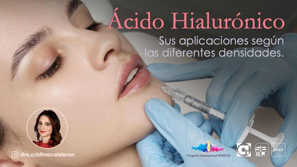 Presentación para ponencia de la Doctora Cristina Calderón sobre armonización orofacial con ácido hialurónico
