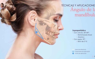 Dra. Cristina Calderón. Formaciones en armonización orofacial