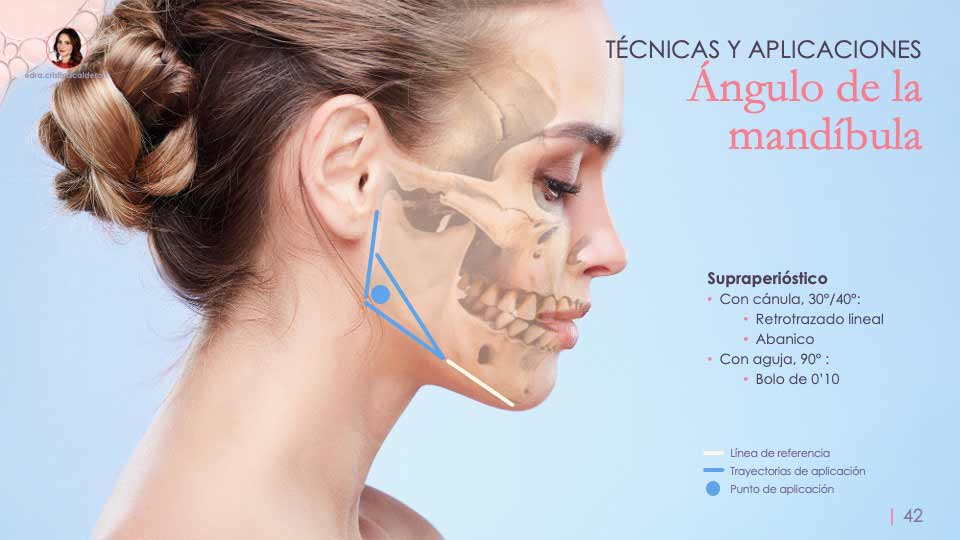 Dra. Cristina Calderón. Formaciones en armonización orofacial