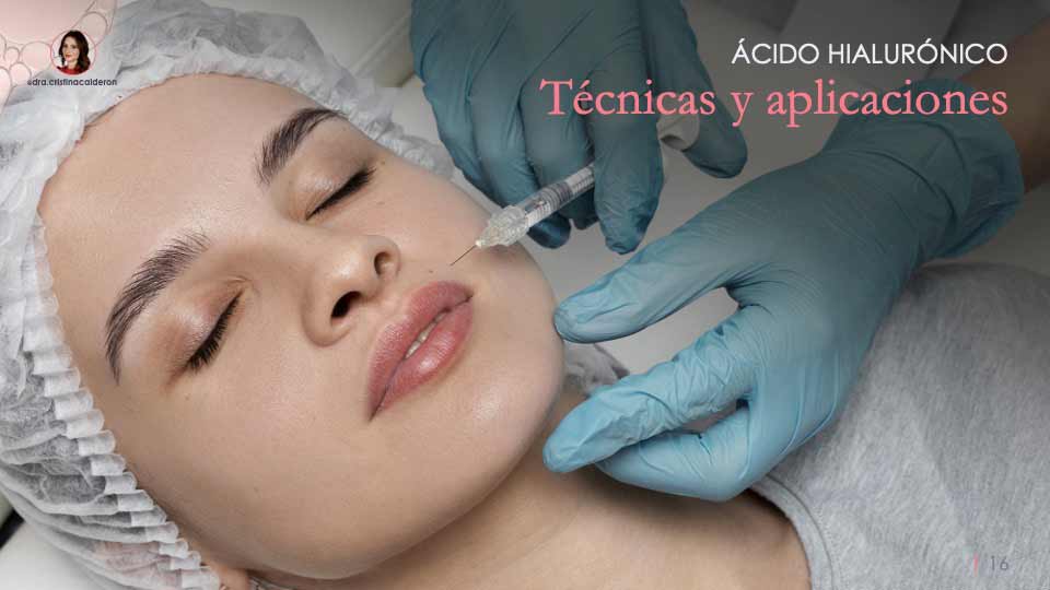 Presentación para ponencia de la Doctora Cristina Calderón sobre armonización orofacial con ácido hialurónico