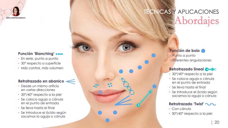 Presentación para ponencia de la Doctora Cristina Calderón sobre armonización orofacial con ácido hialurónico